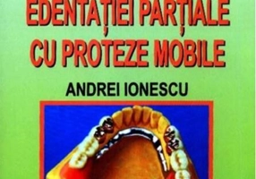 Tratamentul edentației parțiale cu proteze mobile