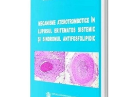 Mecanisme aterotrombotice in lupusul eritematos sistemic si sindromul antifosfolipidic