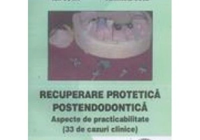 Recuperare protetica postendodontica 33 de cazuri clinice - Ion Coca