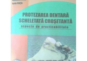Protezarea dentara scheletata crosetanta. Practibilitate - Ion Coca