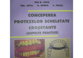 Conceperea protezelor scheletate crosetante - Ion Coca