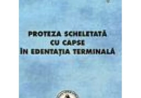 Proteza scheletata cu capse in edentatia terminala - Mihaela Pauna