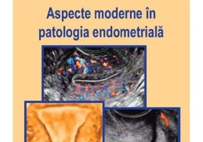 Aspecte moderne in patologia endometriala
